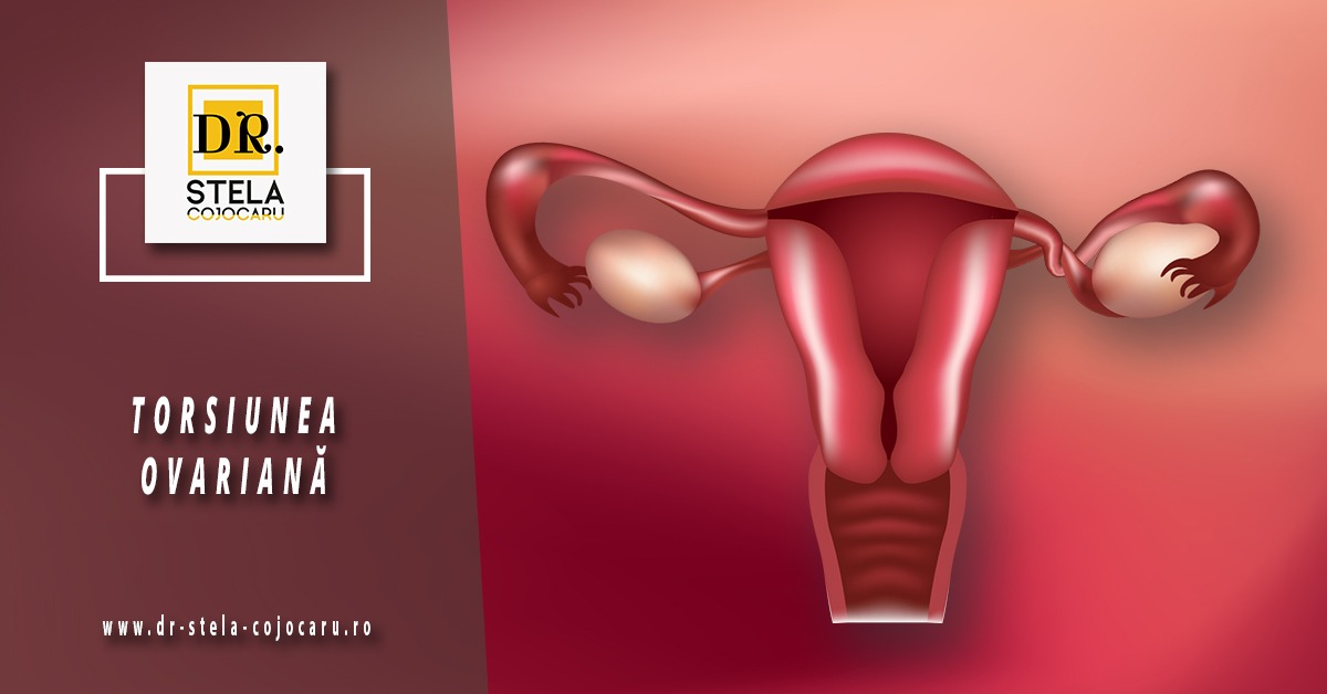 Torsiunea Ovariană: Cauze, Simptome, Diagnostic și Tratament